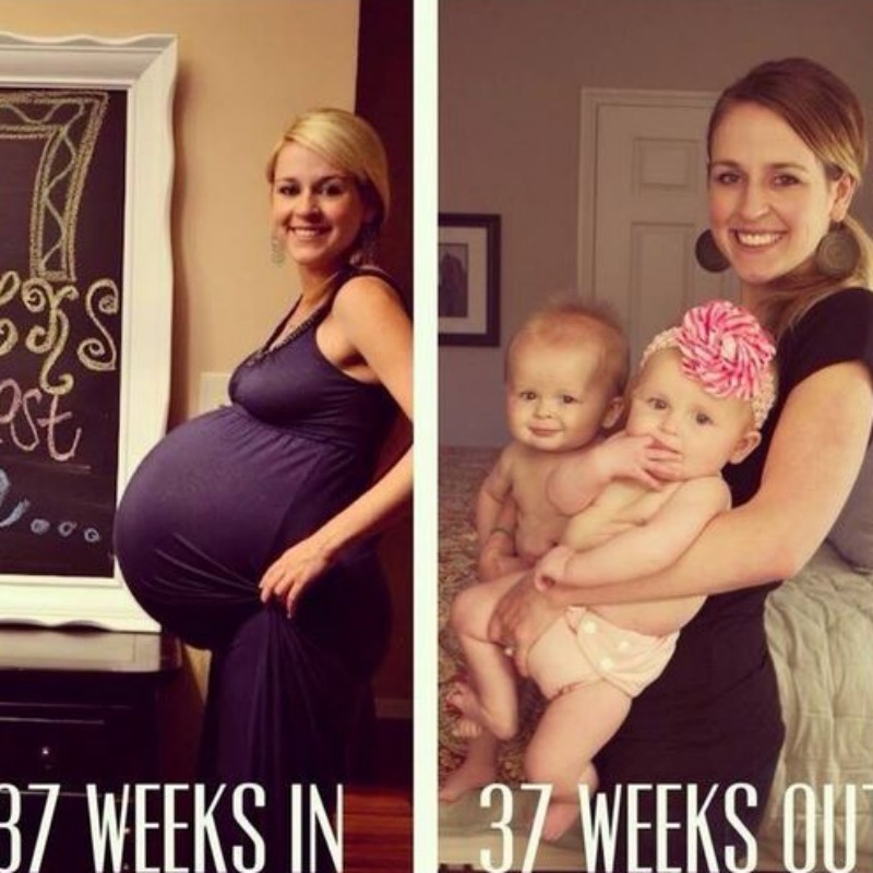 11 Pregnancy Before And After Photos That Will Make You Gasp First For Women