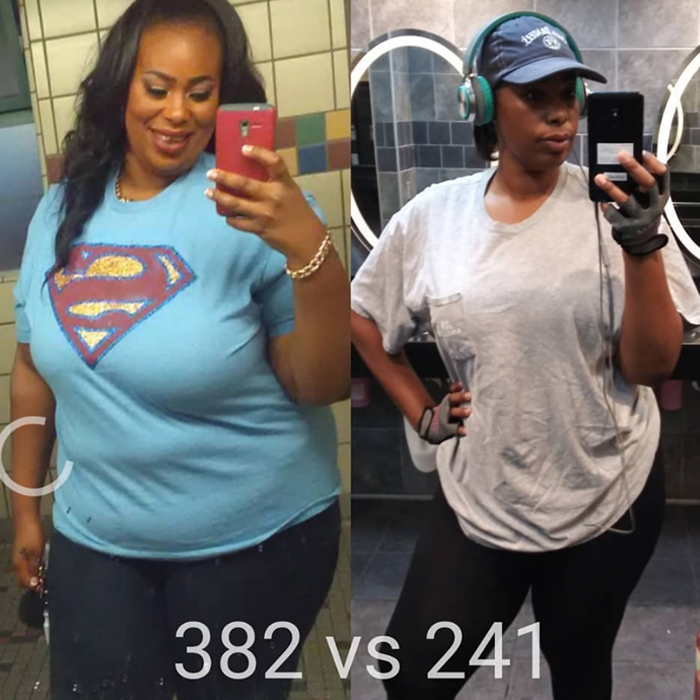 gastric bypass before and after women