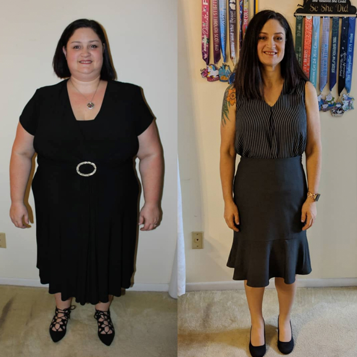 The Most Inspiring Gastric Bypass Before and After Photos