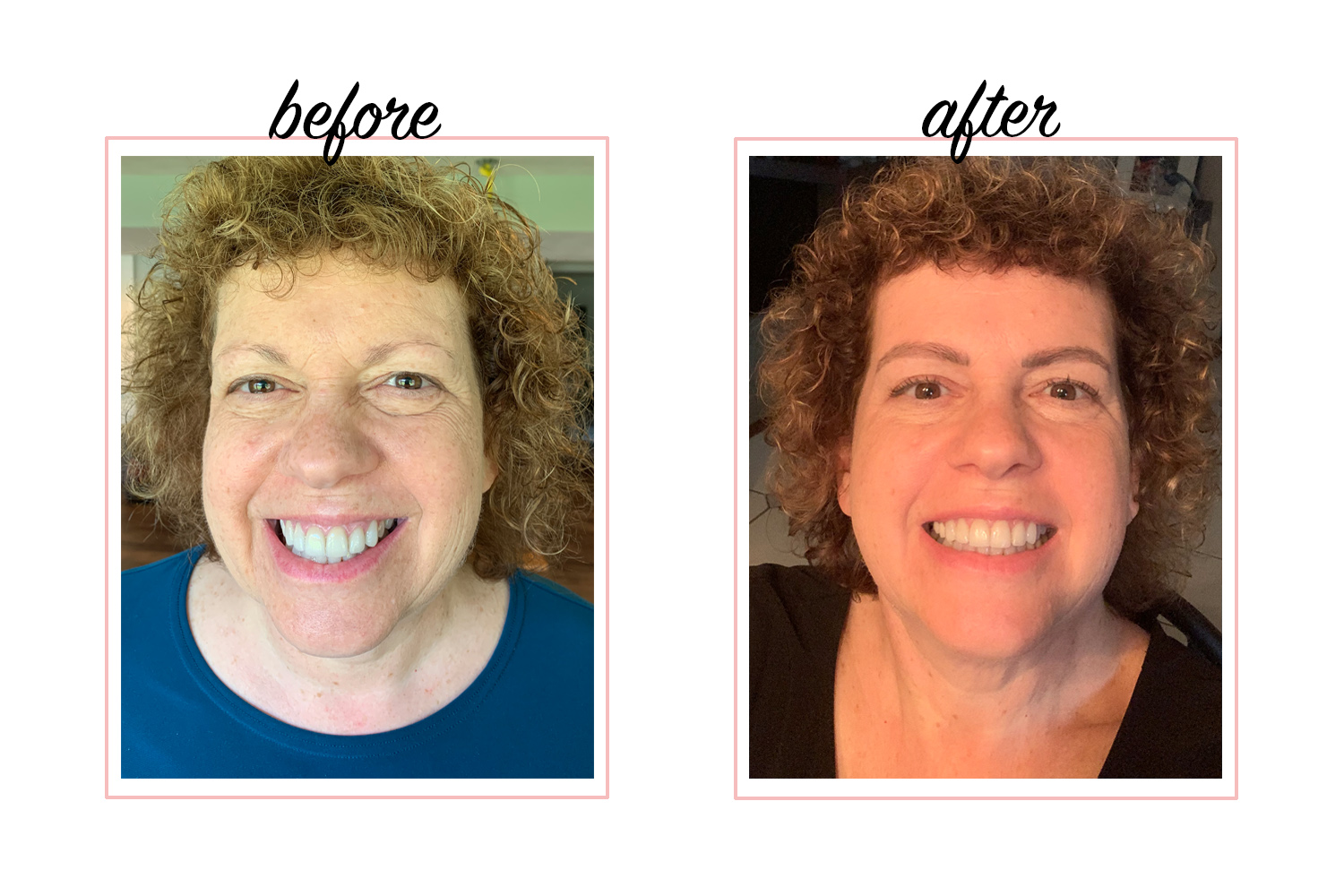 Microblading Before And After Photos For Women Over 50