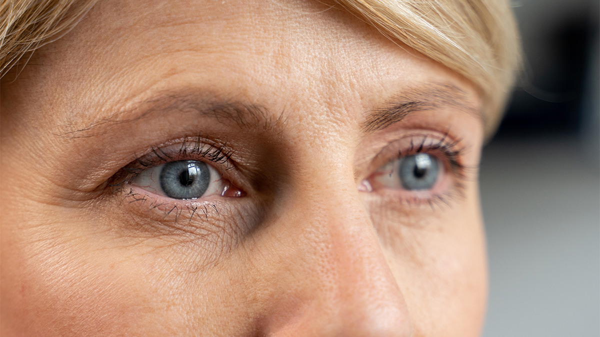 How To Fix Droopy Eyelids Without Surgery Mds Best Advice First For Women 